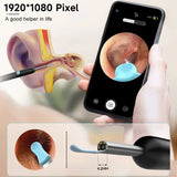 Kit de caméra intelligente pour soins des oreilles