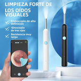 Kit de caméra intelligente pour soins des oreilles