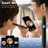Kit de caméra intelligente pour soins des oreilles